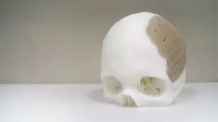 图4:生物3D头骨打印技术