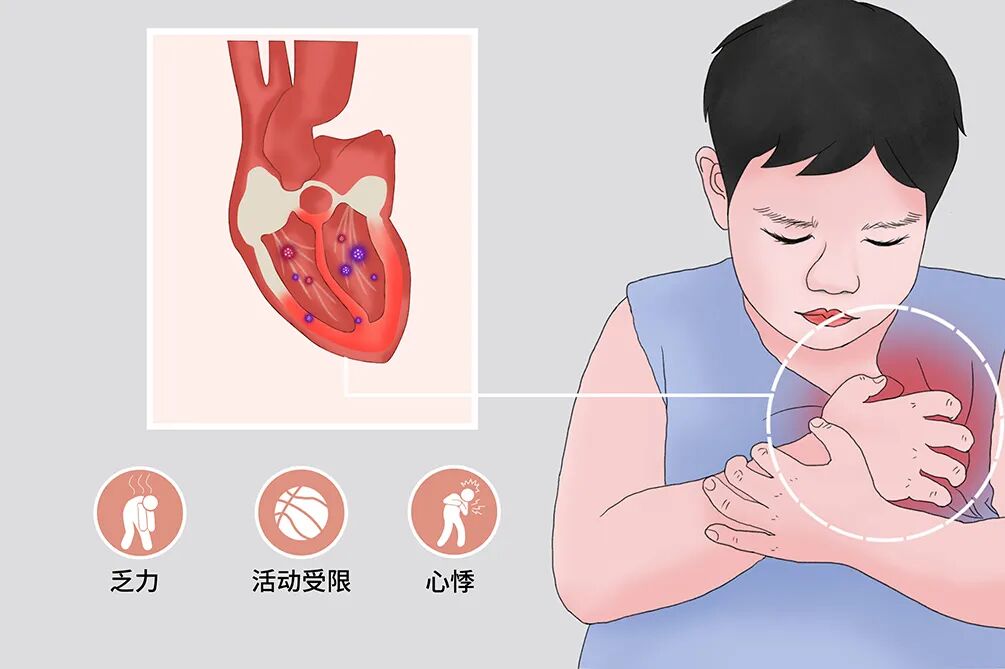 图6:心肌炎