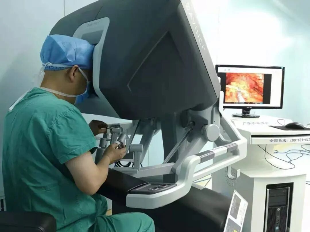 图4:腔镜手术机器人成功运用于泌尿外科手术